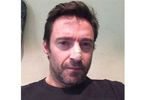 Hugh Jackman Krebsdiagnose