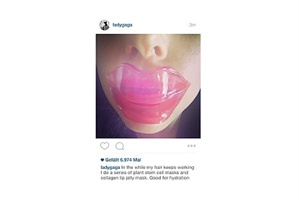 Kylie Jenner Lippen?